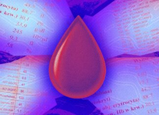 De opkomst van AI-bloedtesten: gepersonaliseerde gezondheidsinzichten of digitaal giswerk?